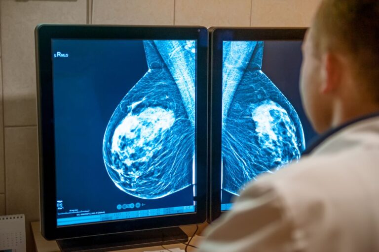 Dépistage du cancer du sein : l’IA à la rescousse des radiologues